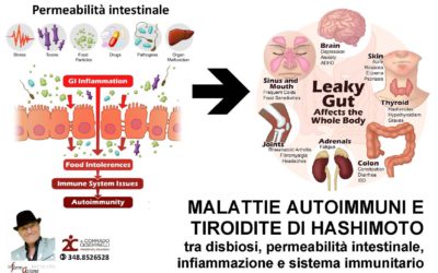 MALATTIE AUTOIMMUNI E TIROIDITE DI HASHIMOTO tra disbiosi, permeabilità intestinale, infiammazione e sistema immunitario
